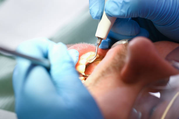 Best Broken Tooth Emergency  in Plafield, IN